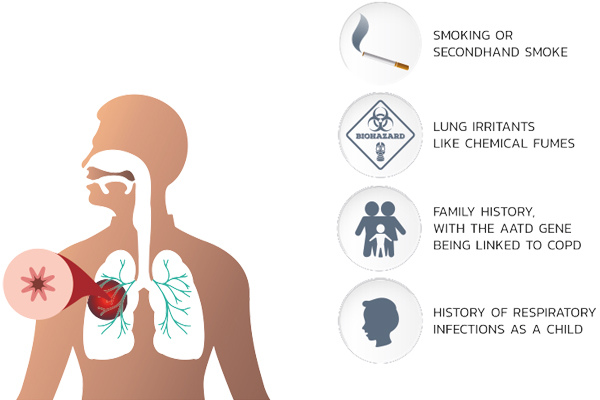 The overall approach to managing stable COPD