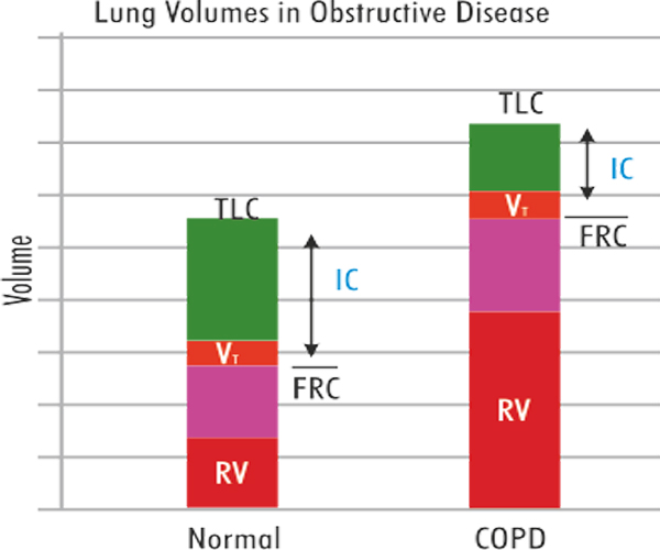 restrictive and obstructive lung disease