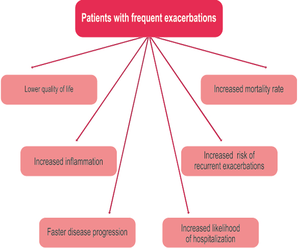 obstructive lung disease